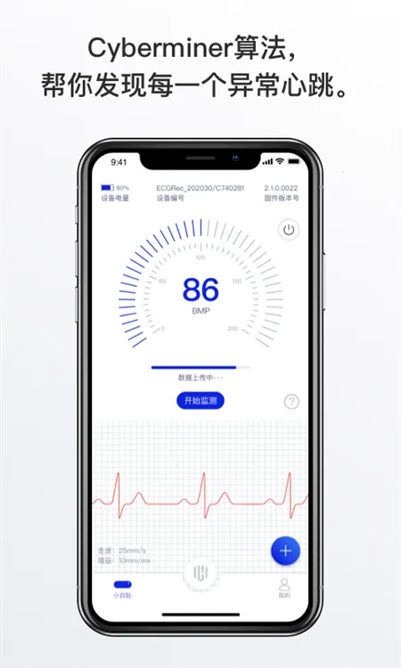 心卫士(心脏健康监测)